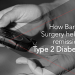 How Bariatric Surgery helps in remission of Type 2 Diabetes?