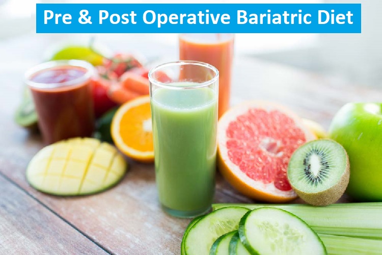 Pre and Post-Operative Bariatric Diet