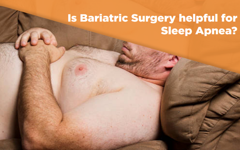 Is Bariatric Surgery helpful for Sleep Apnea