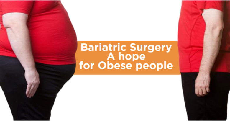 Bariatric Surgery - A hope for Obese people