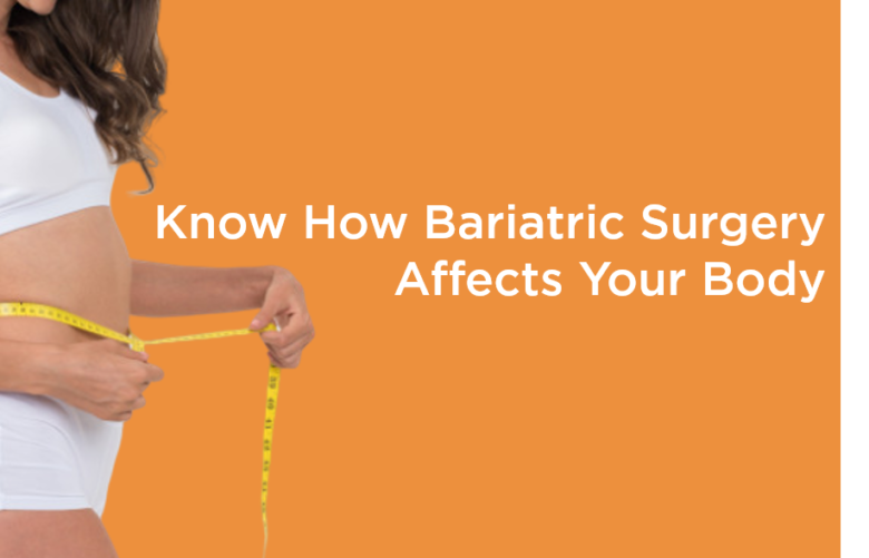 Know how Bariatric Surgery affects your body