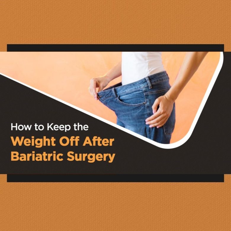 How to Keep the Weight Off After Bariatric Surgery 1