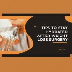 Tips to Stay Hydrated After Weight Loss Surgery 1