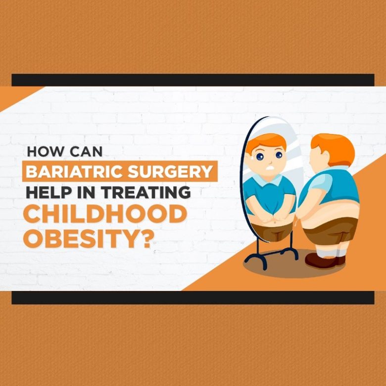 childhood obesity and bariatric surgery