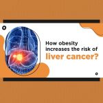 How obesity increases the risk of liver cancer 1