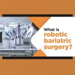 What is Robotic Bariatric Surgery 1