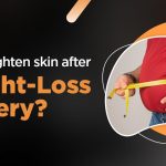 How to tighten skin after weight loss surgery