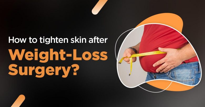 How to tighten skin after weight loss surgery