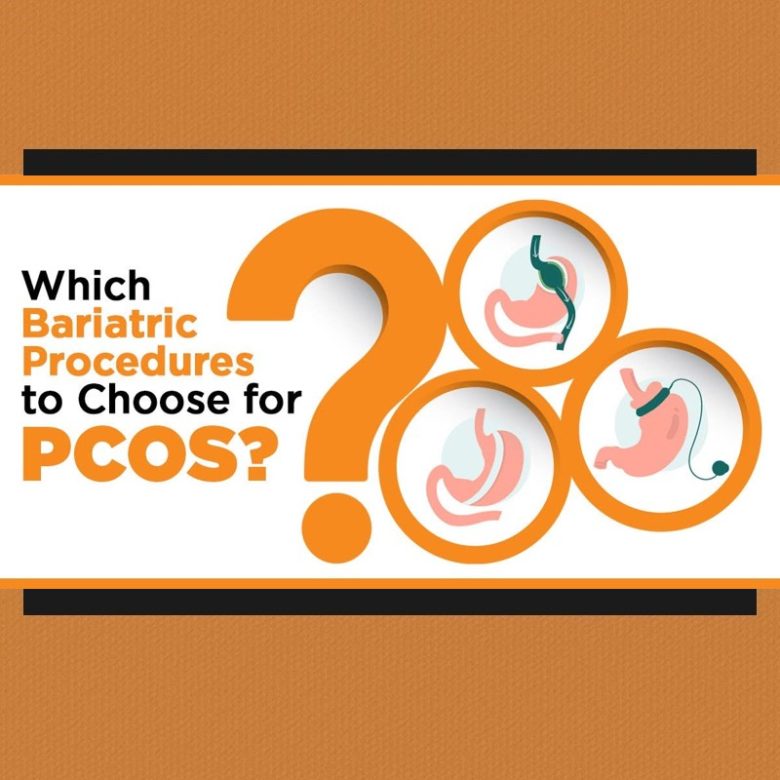 Which Bariatric Procedures to Choose for PCOS