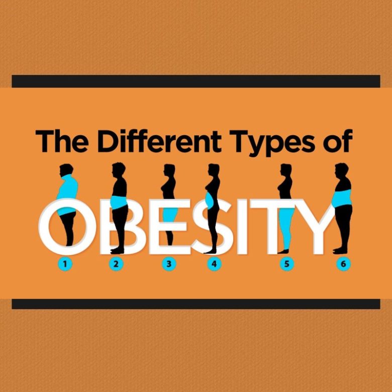 The Different Types of Obesity 1