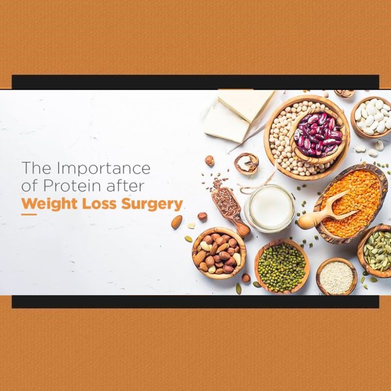 The Importance of Protein after Weight Loss Surgery 1