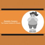 Bariatric surgery the easiest solution to Obesity 1