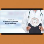 Benefits of Gastric Sleeve Procedure 1