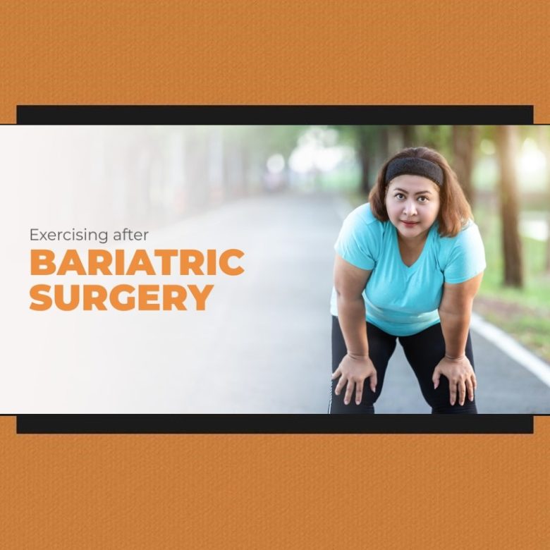 Exercising after Bariatric Surgery 1