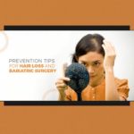 Prevention Tips for Hair Loss and Bariatric Surgery 1