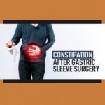 Constipation After Gastric Sleeve Surgery 1