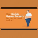 Can Gastric Bypass Surgery be performed twice 1