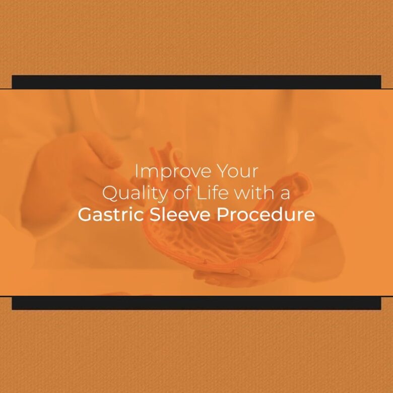 Improve Your Quality of Life with a Gastric Sleeve Procedure 1